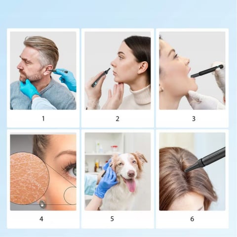 Dispozitiv inteligent de curățare a urechilor